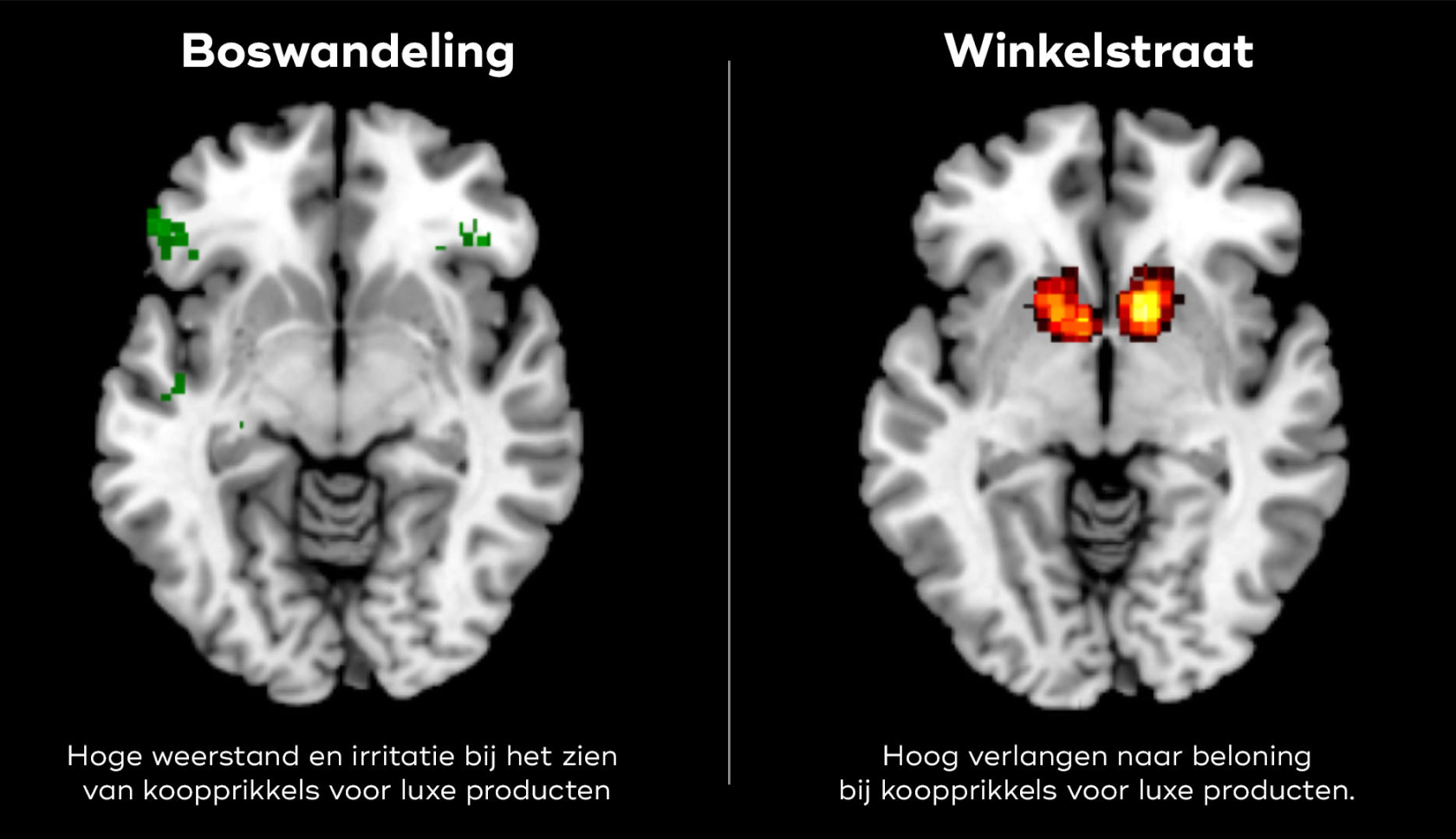 Onderzoekers maten hersenactiviteit van deelnemers die werden blootgesteld aan verschillende omgevingen